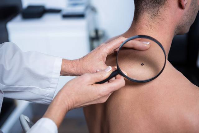 التحقق من العلامات الأولى لمرض سرطان الجلد